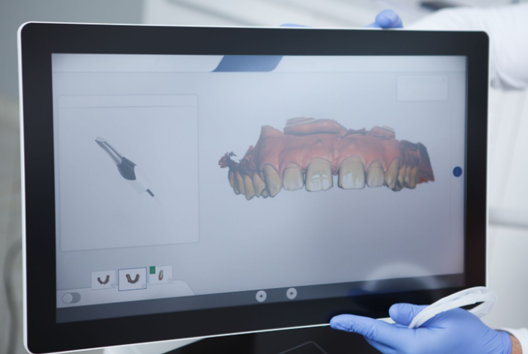 dental_scanner