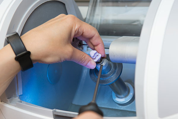 benefits-of-cerec-computer-aided-design-and-manufacturing